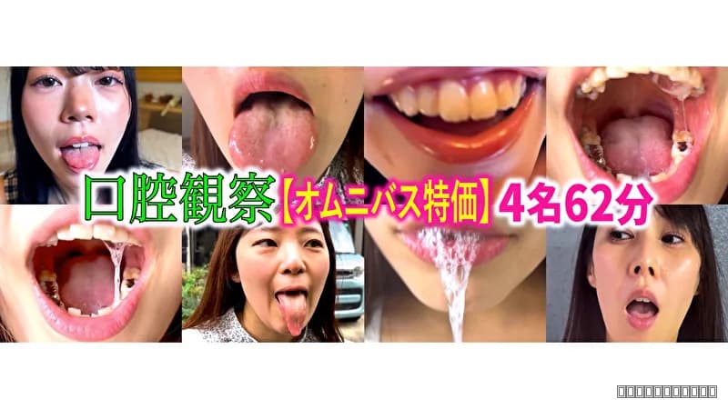 【特価】口腔観察 VOL.4 4名62分お買い得セット