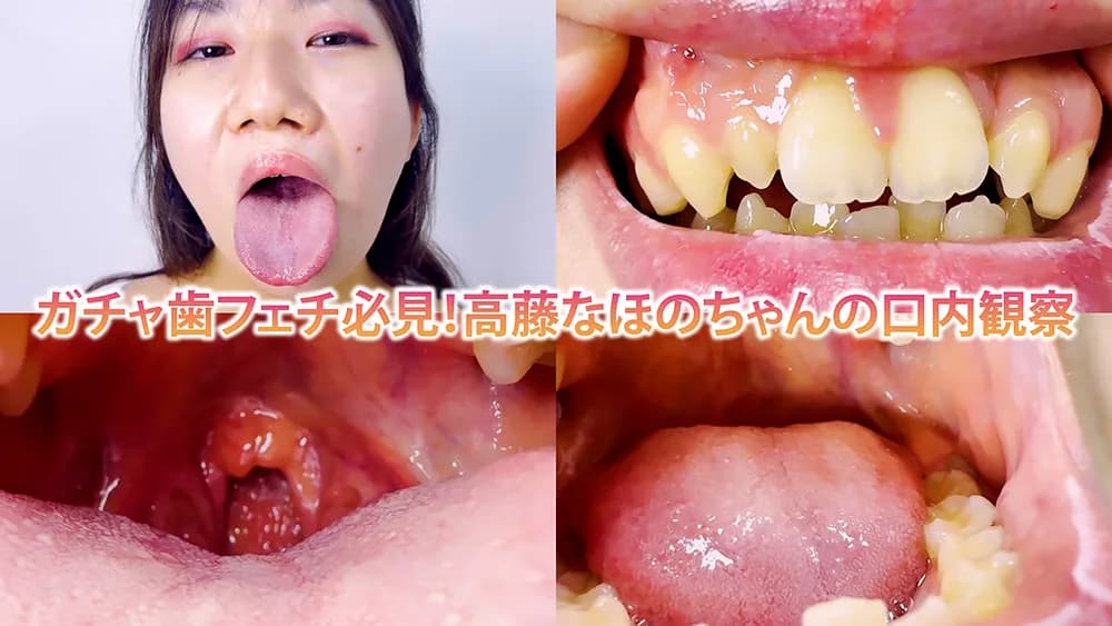 ガチャ歯フェチ必見!高藤なほのちゃんの口内観察
