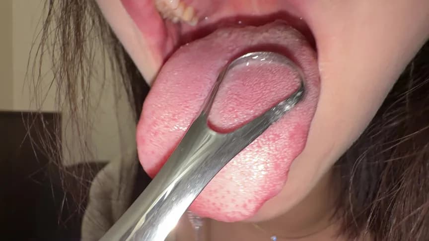 【個人撮影】彩川ゆめ 舌ブラシで「汚舌苔」採取 サンプル1