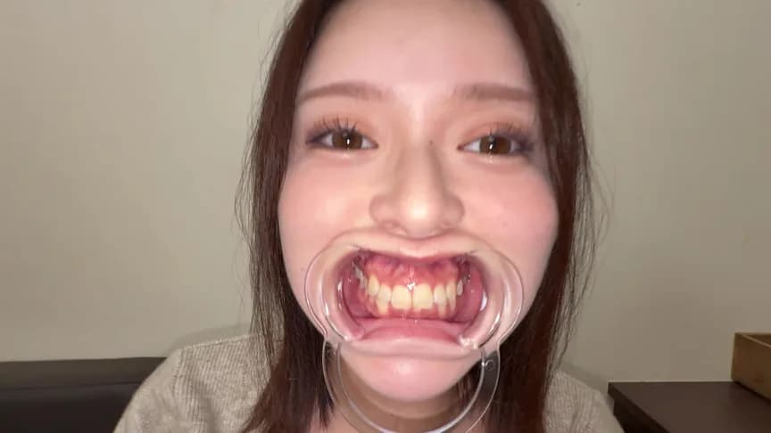 【個人撮影】彩川ゆめの喉チン触り＆開口器Wピース サンプル2