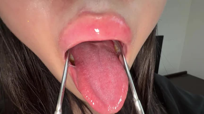 【個人撮影】ゆうきすずの舌ブラシで「汚舌苔」採取 サンプル4